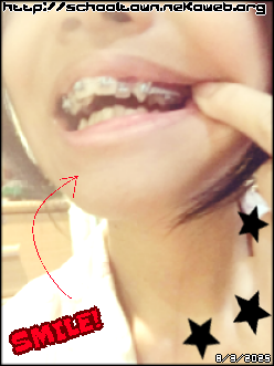 Me with braces on the top teeth, the color of the bands are light blue